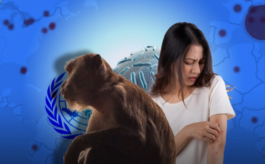 استراتيجية مكافحة جدري القرود مع منظمة الصحة العالمية